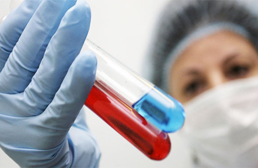 AIDS tarihe mi karışacak? Saklandığı hücre tespit edildi