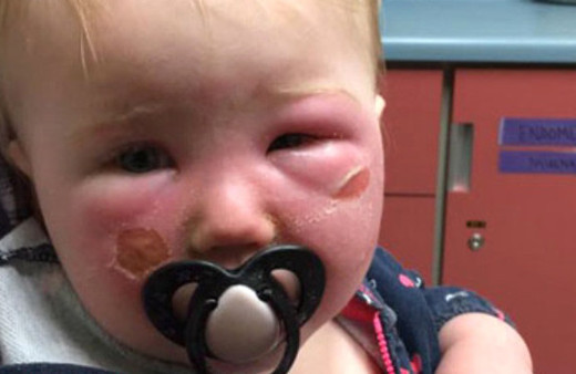 Ödünç krem bu hale getirdi!