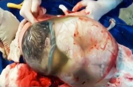 Bebek bu halde dünyaya geldi doktorlar şoke oldu