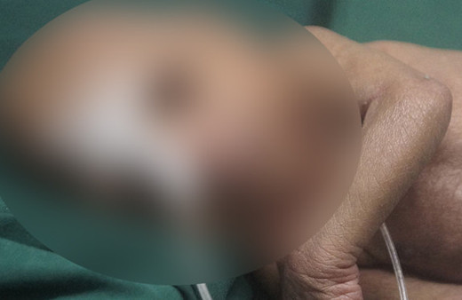 Yaşlı olarak doğdu! Gerçek Benjamin Button