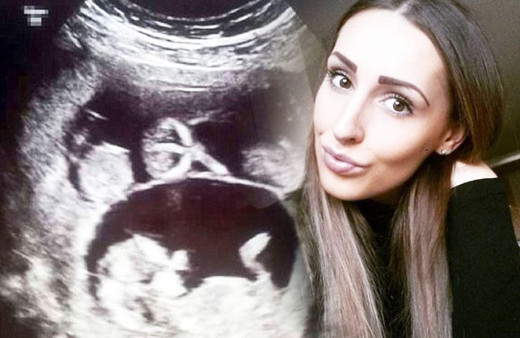 Taşıyıcı anne oldu ama ultrasonda girince gözlerine inanamadı!