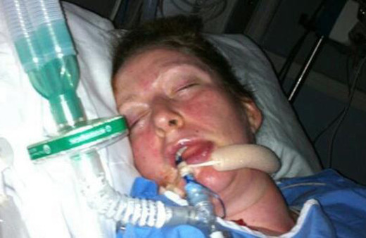 Baş ağrısına dikkat! Cinsel ilişki sonrası felç geçirdi...