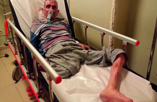 Oksijen maskesi ile sigara içmeye kalkışınca...