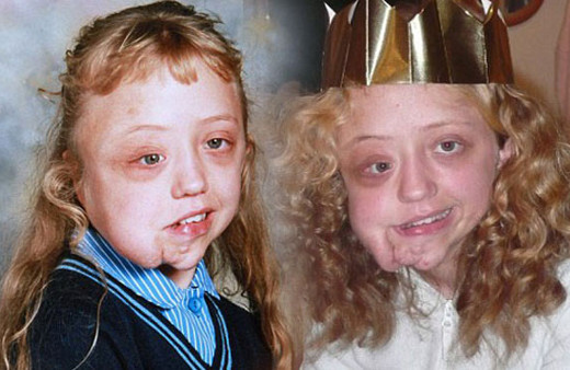 Hayatı boyunca herkes onunla dalga geçti sonrası inanılmaz