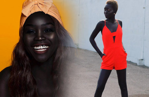 Herkes onunla aşırı siyah diye dalga geçti şimdi dünya peşinde!