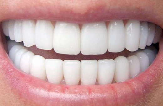 Stresten dişlerinizi kaybetmeyin