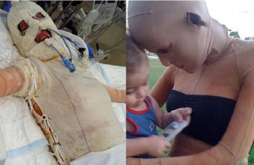 Kıskanç kadın yüzünü bu hale getirdi