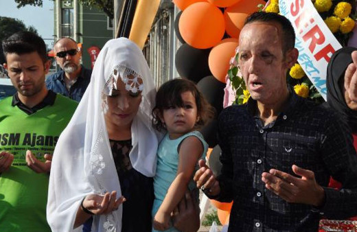 Yüz nakli olan Recep Sert patron oldu