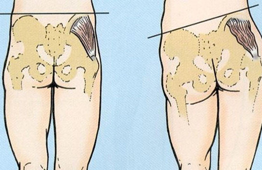 Oturarak çalışanlar dikkat ölü popo sendorumuna yakalanmış olabilirsiniz