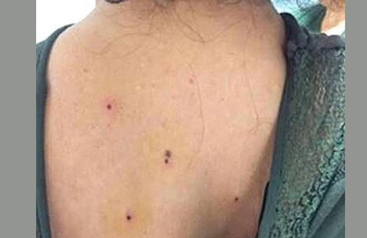 Kına eğlencesinde bu halde geldi nedeni ise...