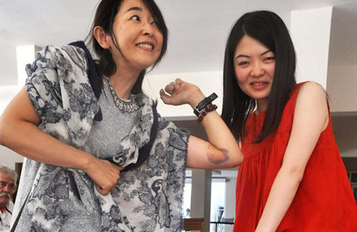 Caretta carettalar ısırdı onlar böyle poz verdi