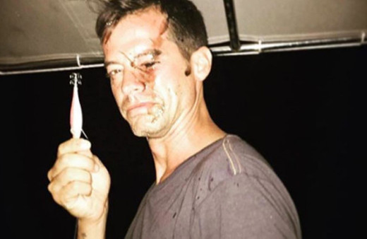 Alp Kırşan'a ne oldu öyle yüzüne bakın hayranları şoke oldu