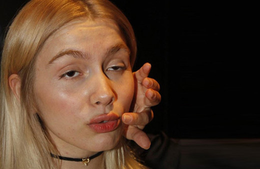 Aleyna Tilki dudaklarına dolgu mu yaptırdı işte yanıtı