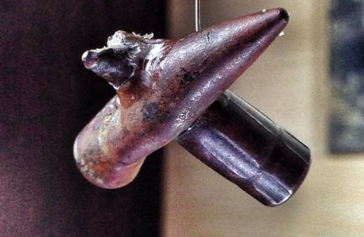 Milyonda bir ihtimalleri görüntülediler