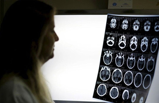 Bu kamera insan vücudunun içini gösteriyor