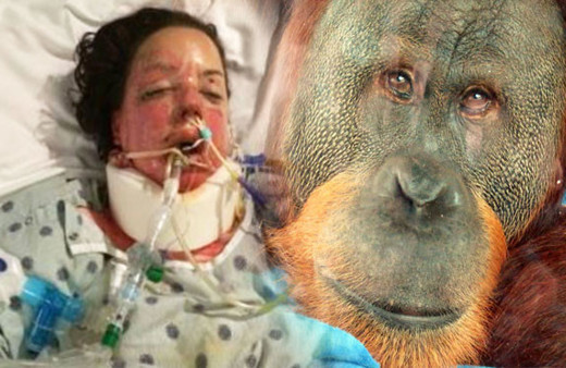 Hayatını karartan kazadan sonra onu hayata orangutan döndürdü