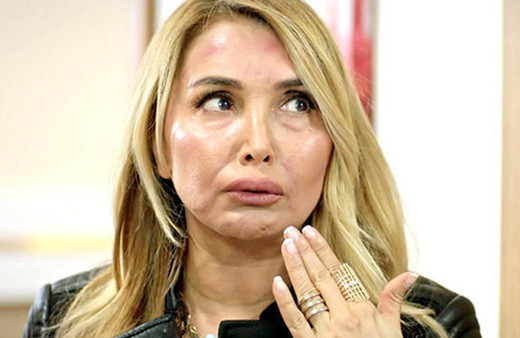 Yonca Evcimik'ten büyük ayıp: O kim ya?