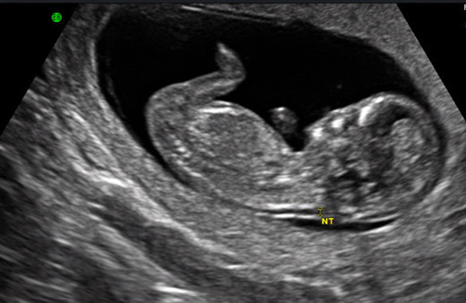 O sadece beş yaşında ve anne oldu akıl almaz dehşet!