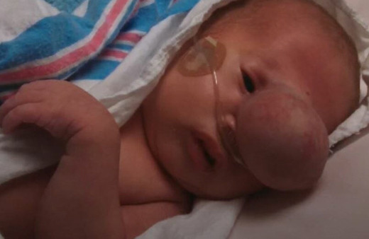 Bebeğin yüzündeki yumru gittikçe büyüyordu doktor gördü ve...