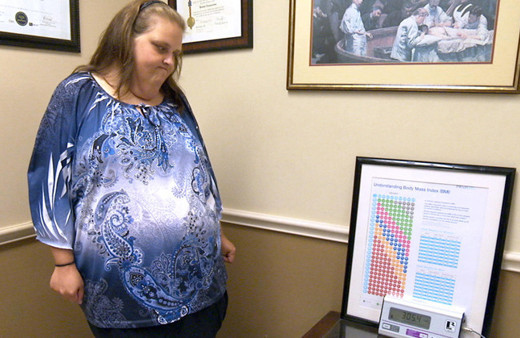 Tüp mide ameliyatı sonrası cinsel ilişki ve iyileşme süreci