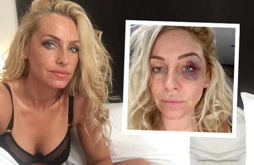 Ünlü televizyon yıldızını takside darp ettiler!