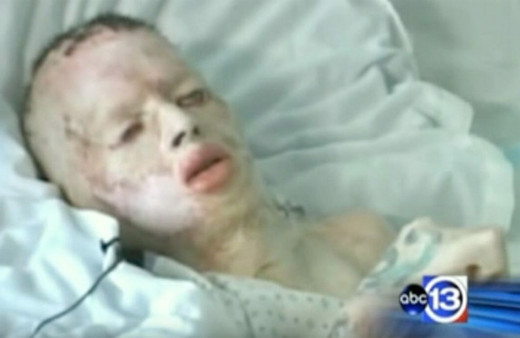 Bu hale getirdi 8 yaşındaki çocuğu ağaca bağlayıp önce diri diri yaktı sonra...