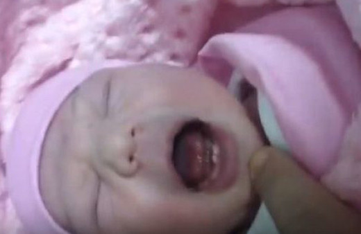 Ailesi de doktorlar da şaşkına döndü! Yeni doğan bebeğin...