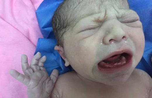 Ailesi de doktorlar da şaşkına döndü! Yeni doğan bebeğin...