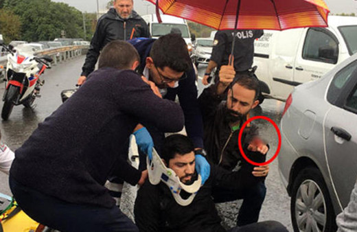 Korkunç kaza! Motosiklet sürücüsünün parmağı koptu