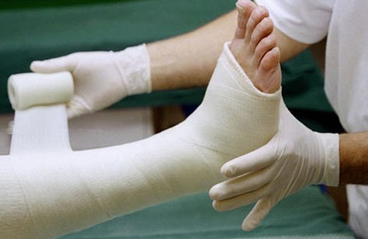 İşte kırıklar hakkında doğru bildiğimiz 5 yanlış!