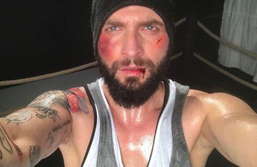 Berkay sahneye çıkabilecek mi? Doktoru Beyaz TV'de açıkladı 