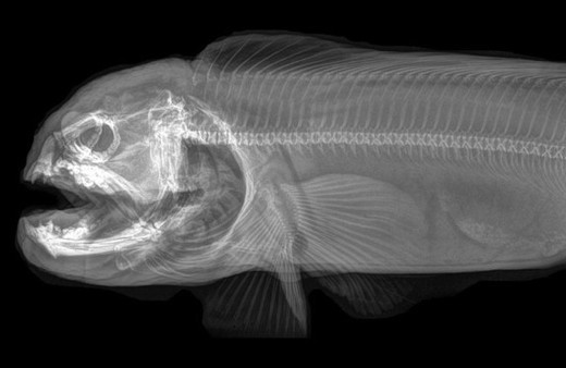 Sağlık kontrolleri için X-Ray'e girdiler