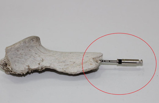 Türk mühendisten dünyada bir ilk! Daha ucuz daha kaliteli