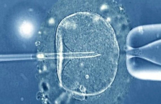 Tüp bebek yaş sınırı kaç oldu şartları ne 32. maddeye dikkat