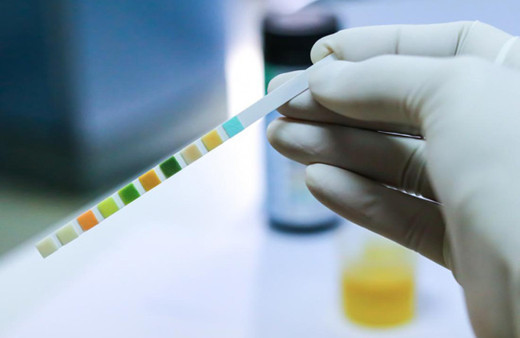 İdrar rengi neyin belirtisi kırmızı ve bordo renkli idrar kötü hastalık