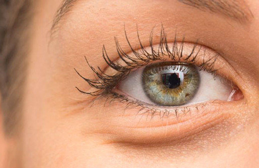 Göz altı torbaları neden oluşur nasıl giderilir? 