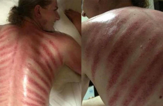 Masaj yaptırmak istedi: Bu hale geldi!