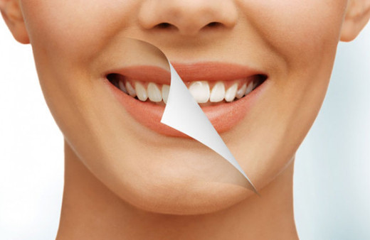 Diş ojesi uygulaması nedir? Diş ojesi uygulaması kimlere yapılır? 