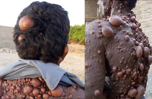 Hastalığı yüzünden evini terk etti görenler yolunu değiştiriyor!