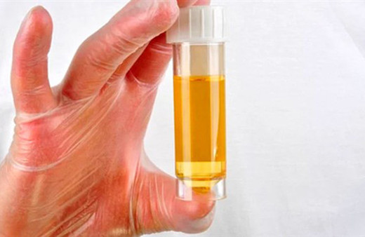 Doktorlardan uyarı: İdrarınızı içmeyin!