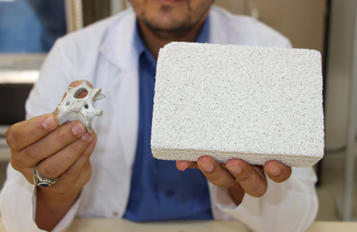 Türk akademisyenden büyük başarı! Yerli imkanlarla yapay kemik üretti