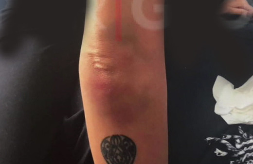 Sıla'nın dayak görüntüleri çıktı Ahmet Kural kafasını duvarlara vurmuş