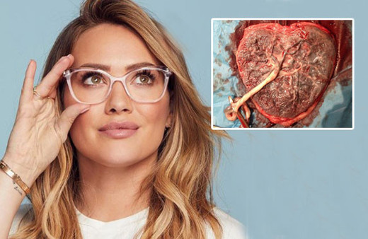  Hilary Duff'tan iğrenç itiraf bebeğinin plasentasını içti
