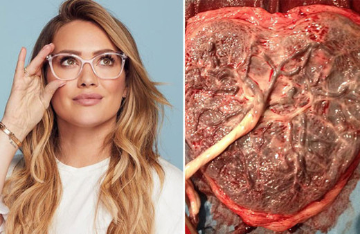 Plasenta nedir Hilary Duff bebeğinin plasentasını içti