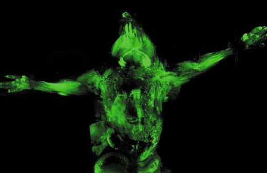 Türk bilim adamından tıp dünyasında şeffaf devrim