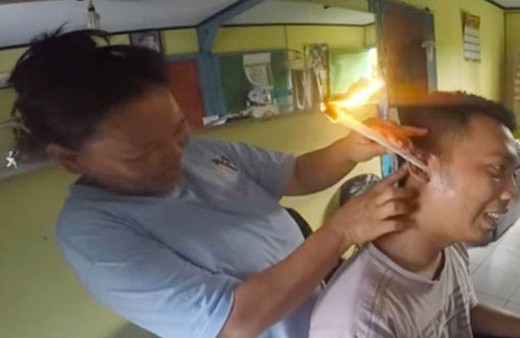 Yok böyle bir kulak temizliği şekli önce yakıyorlar sonra çekiyorlar