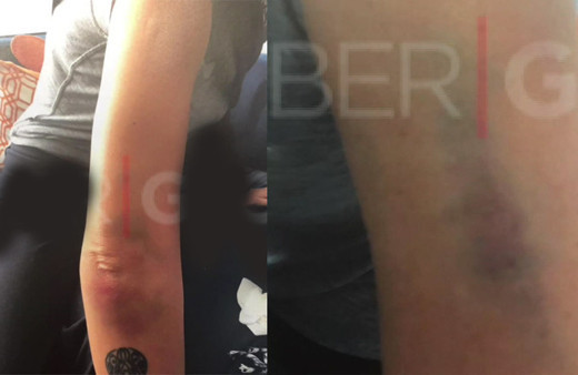 Sıla Ahmet Kural dayak görüntüleri ortaya çıktı üstü parçalanmış