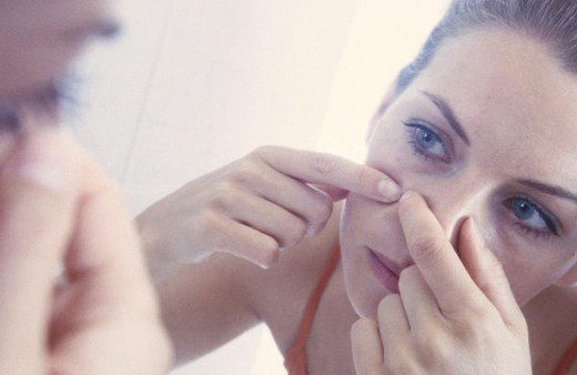 Geçmeyen sivilcelerin asıl nedeni telefonunuz olabilir!