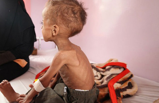 85 bin bebek açlıktan hayatını kaybetti Yemen kan ağlıyor