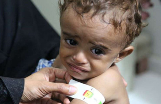 85 bin bebek açlıktan hayatını kaybetti Yemen kan ağlıyor